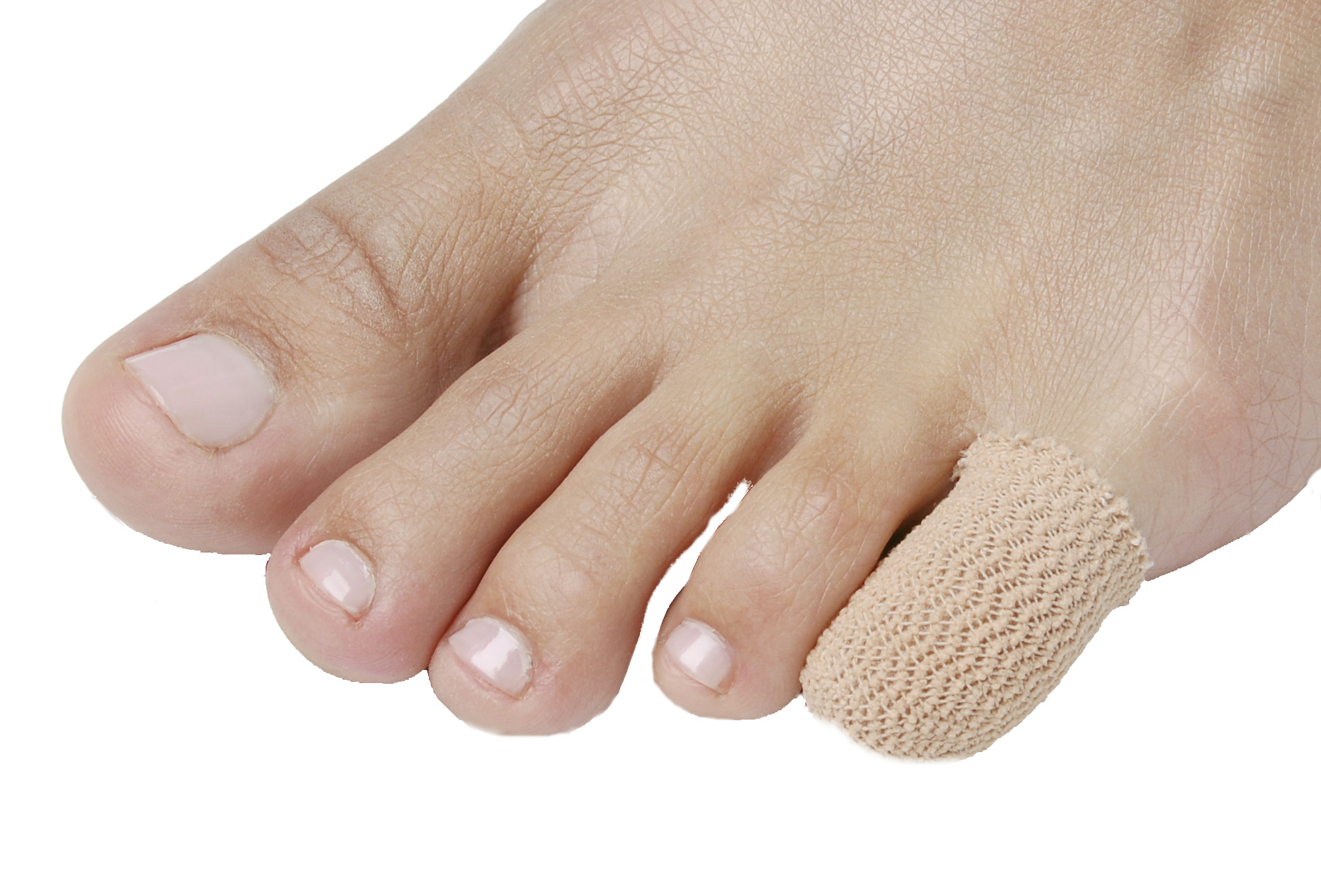 Gelsmart Tåhætte, Almindeligt Stof