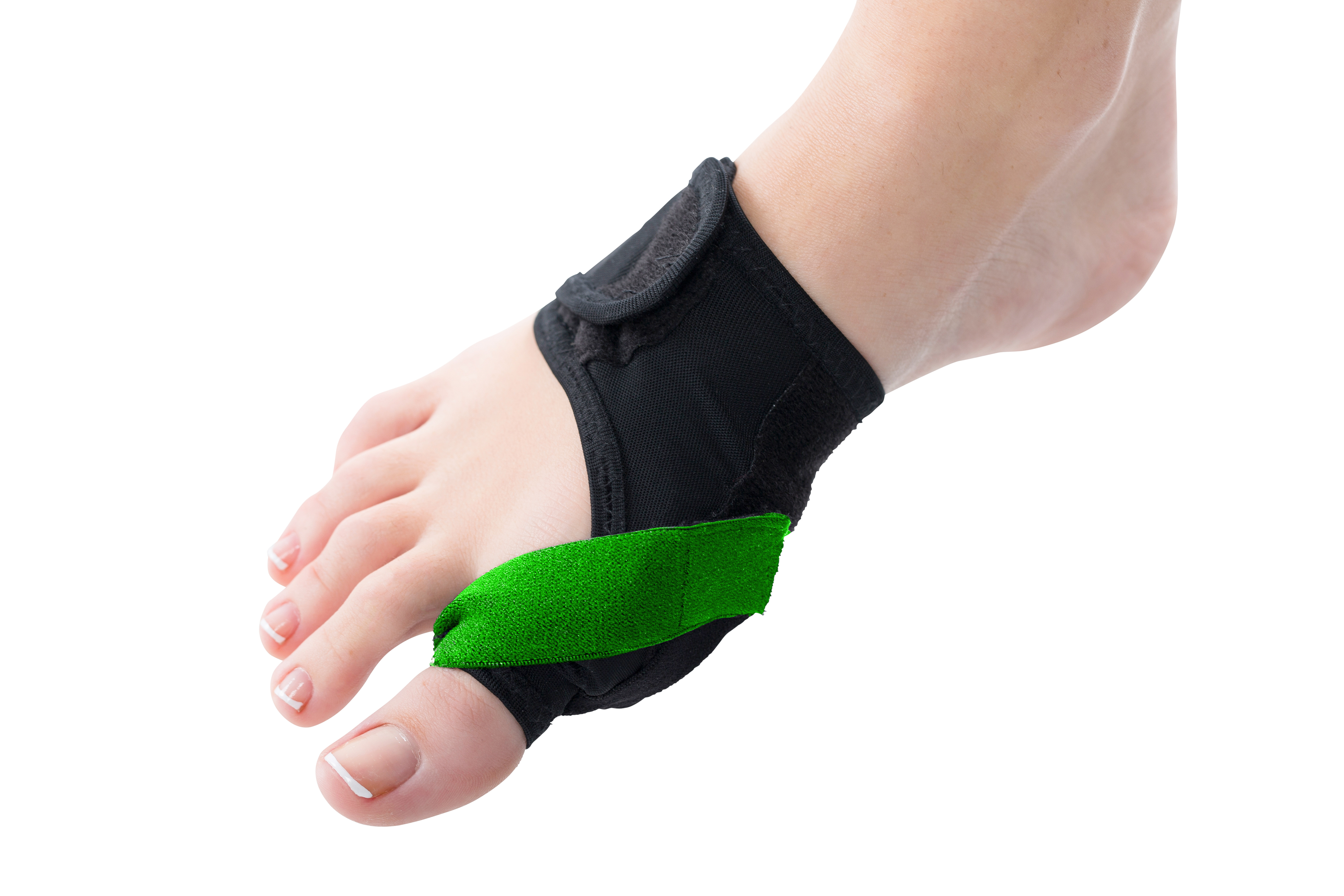 Gelsmart, Natracure, hallux valgus