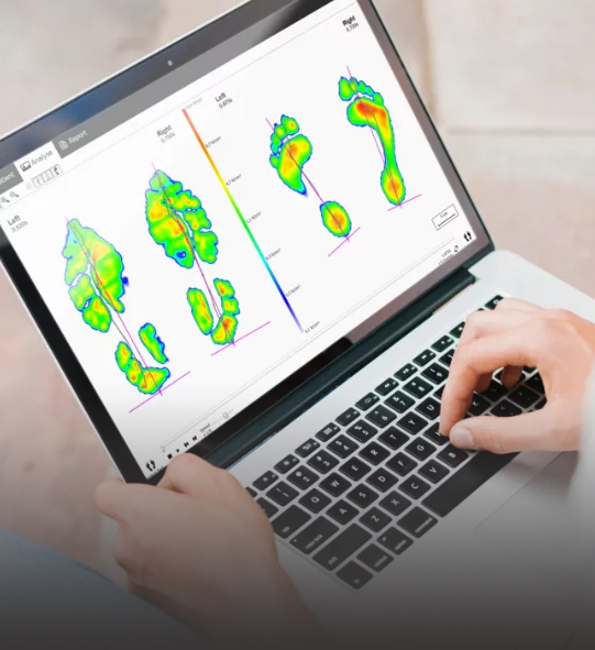 Gratis Footscan workshop