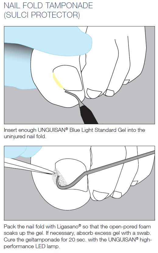 Unguisan, Blue Light, Standard Gel, 3 ml.