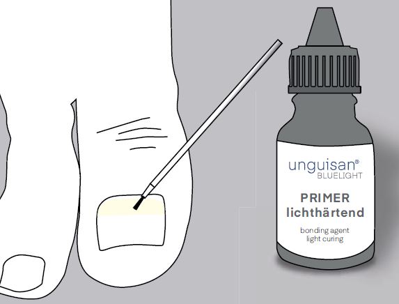 Unguisan, Composit, Primer