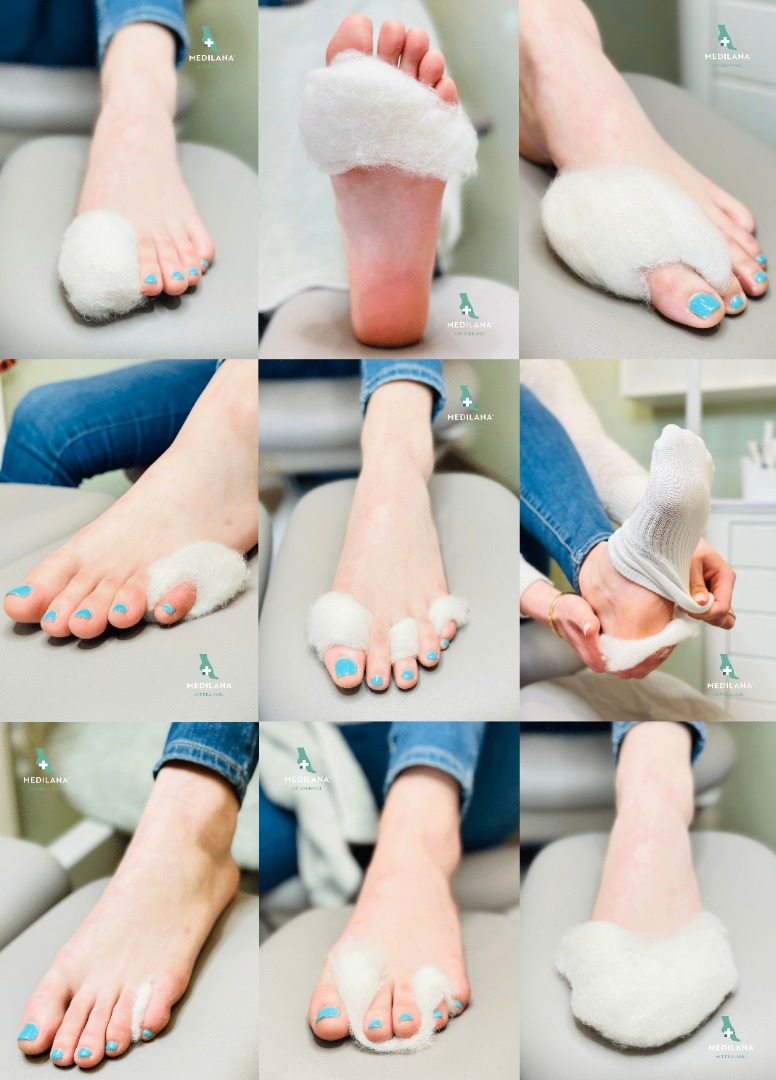 MediLana, trykaflastende uld