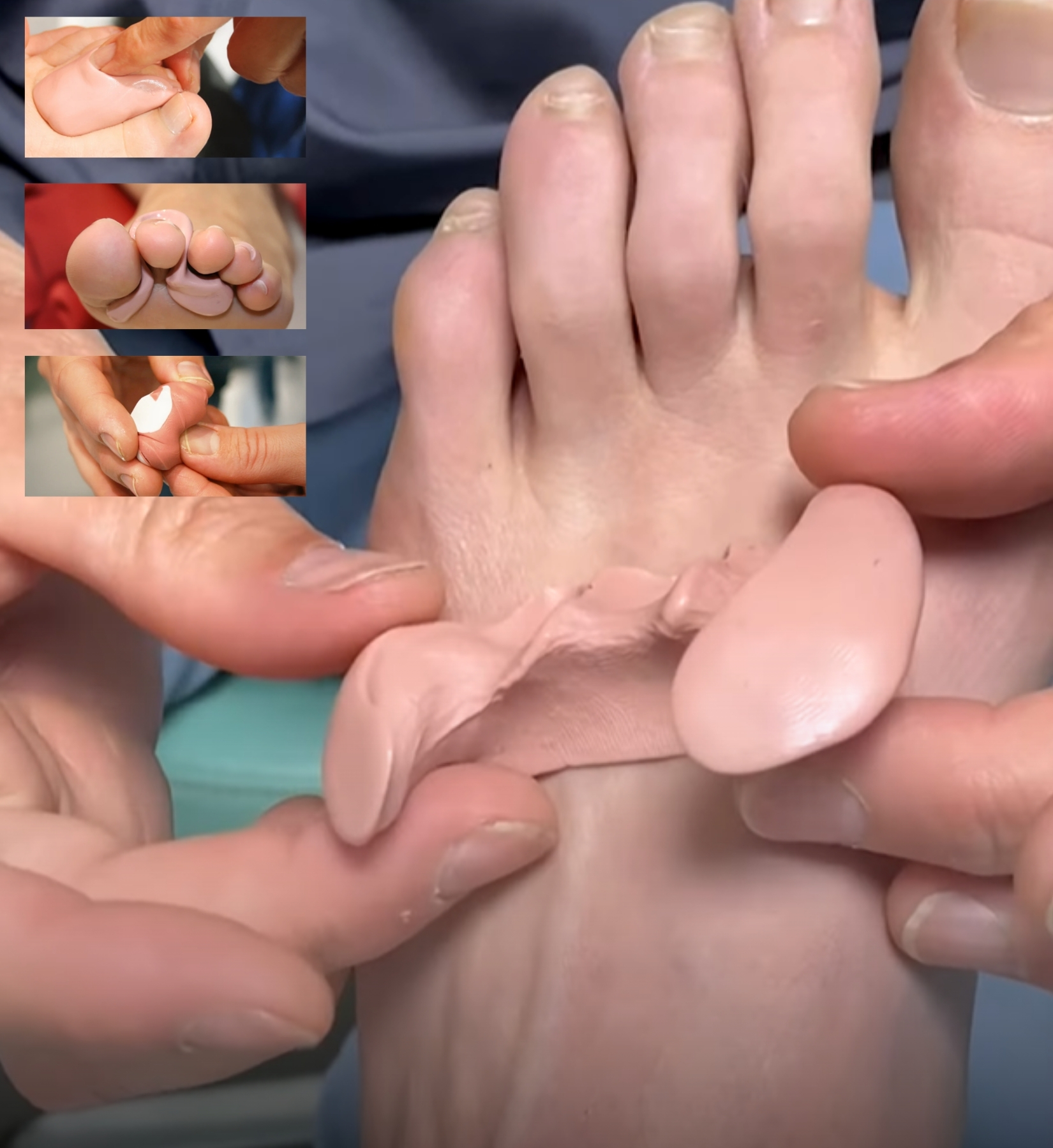 Sicasil A+B, 2 komponent silikone